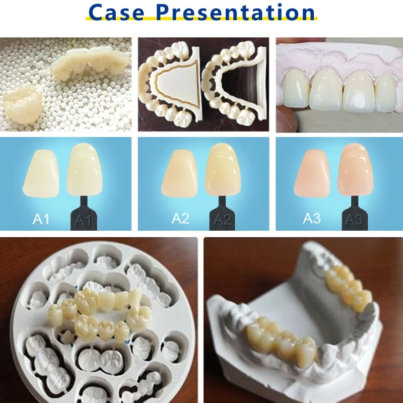 Dentistry Artificial Teeth 98mm ST zirconia disc Dental Zirconia Blank For Crown