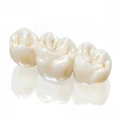 طب الأسنان التجميلي والترميمي