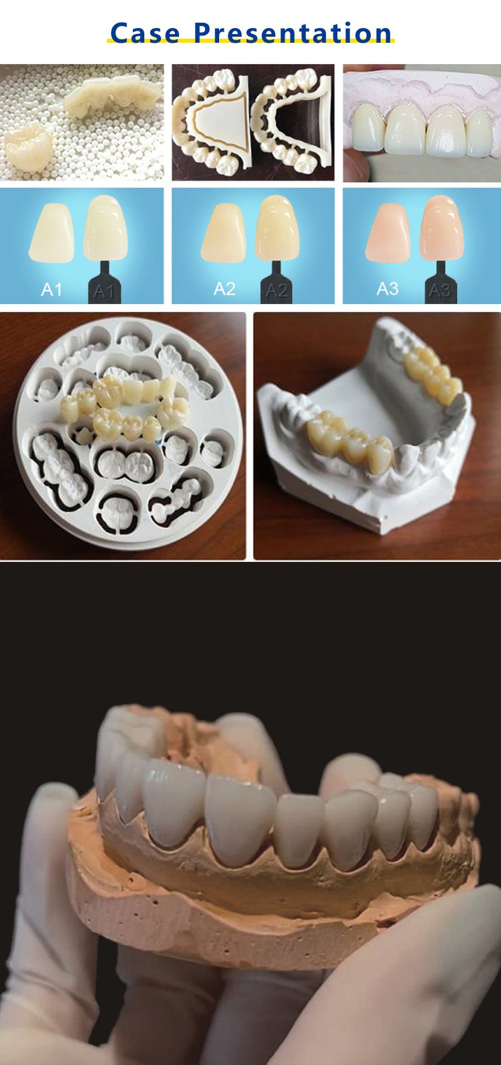 Dental Zirconia Block ZirkonZahn CAD CAM System Compatible Zirconium Disc case presentation Dental Zirconia Block ZirkonZahn CAD CAM System Compatible Zirconium Disc case presentation
